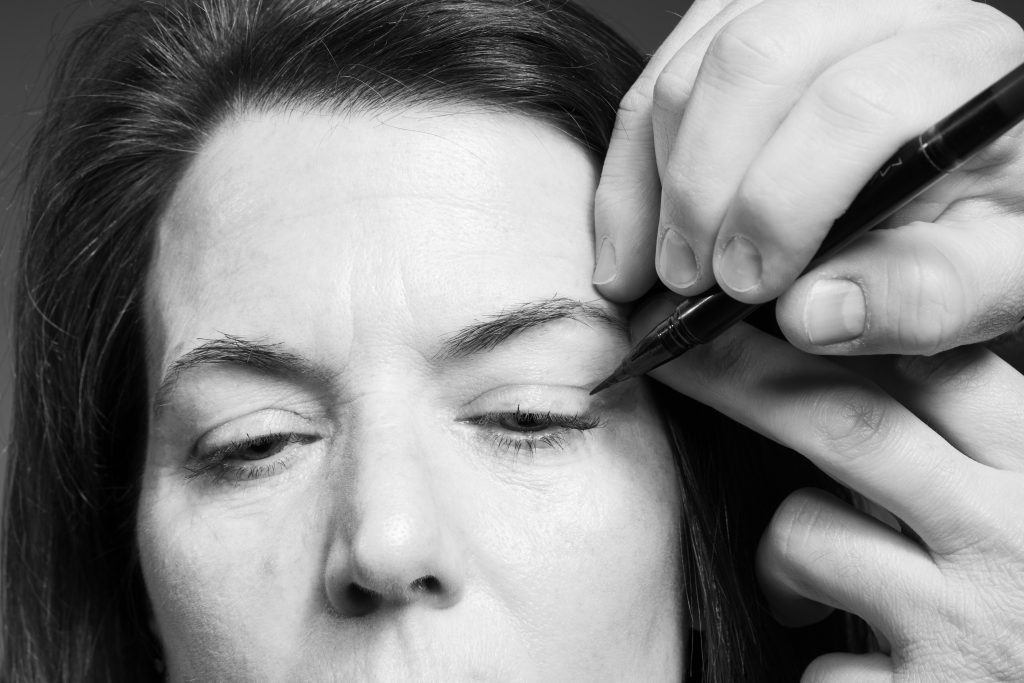 Droopy Eyelid Treatment Options